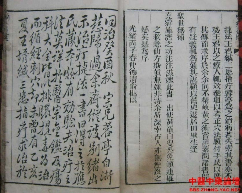 图片[5]-刺疔捷法-1876年首刊版-四书格